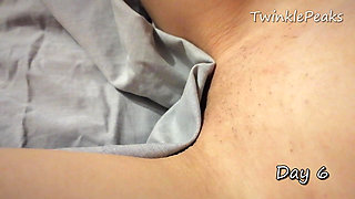Pussy Hair Growth after deep bikini sugar wax