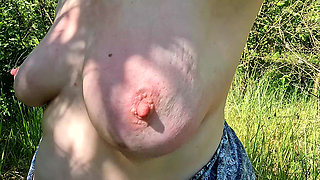 Nipple