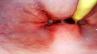 EXTRAORDINAIRE. CAMERA INWARDS HER VULVA WHILE I CRAM HER WITH JIZZ