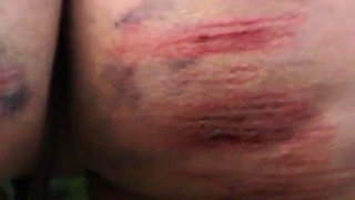 Slave Mila Plays with Her Bruised Caned Bottom Outdoors