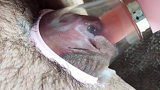 Selection of Vacuum Masturbation of the Vagina