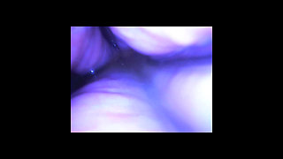Speculum & Microcamera for Lady Soniac