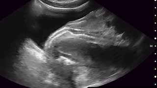 Legrand Wolf cock fully inside Alex Gonx hole on ultrasound
